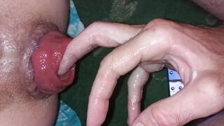 Трахни мой сочный пролапс порно